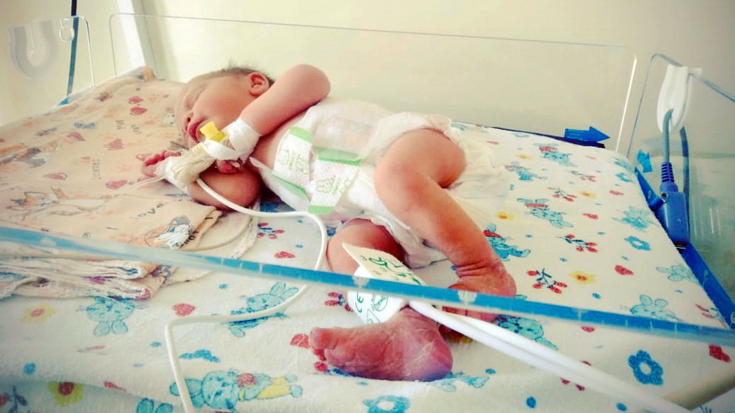 Ступинские врачи спасают новорожденного младенца после домашних родов